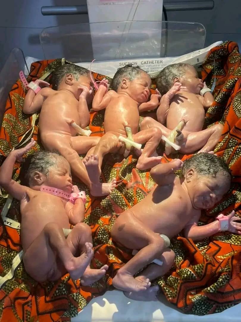 [EXCLUSIVITE] MATERNITÉ À DJOUGOU: Tout sur les quintuplés de l'hôpital de l'Ordre de Malte